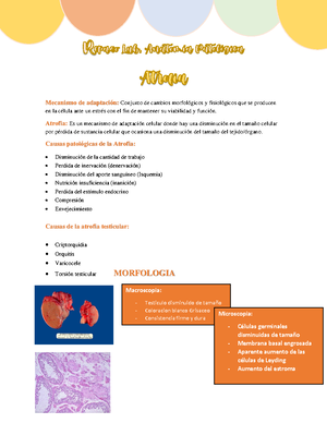 Macro y microscopia - Atrofia senil de testiculo Atrofia senil de ...