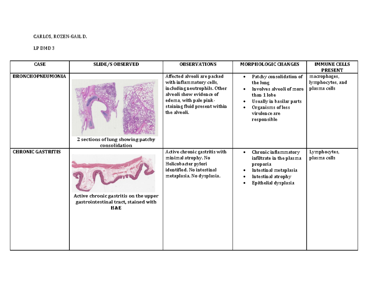 Module 3 L2 Activity - Carlos, Rozen-gail D. Lp Dmd 3 Case Slide S 