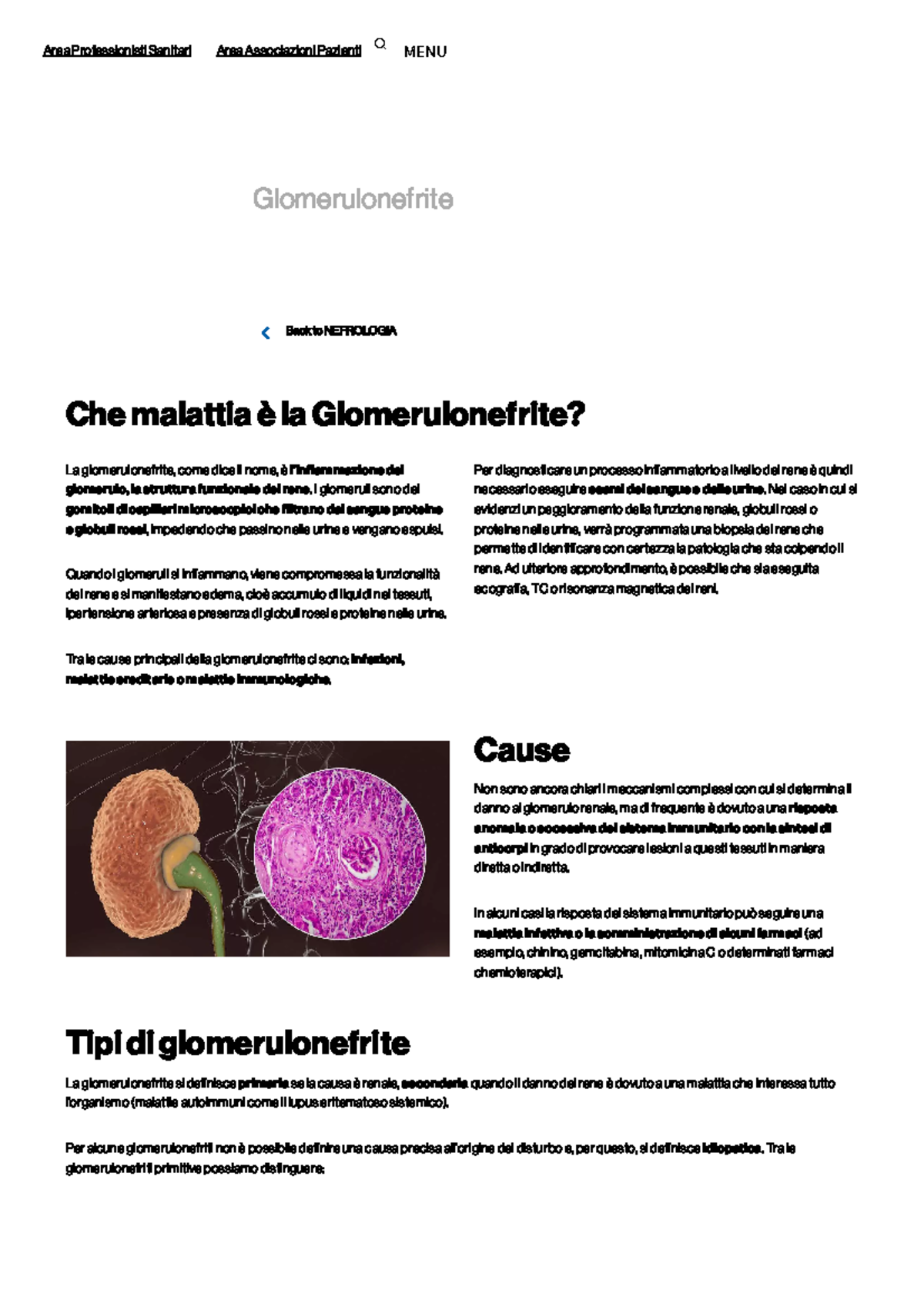 Glomerulonefrite tipi di nefrite, sintomi, cause e terapia - Back to ...