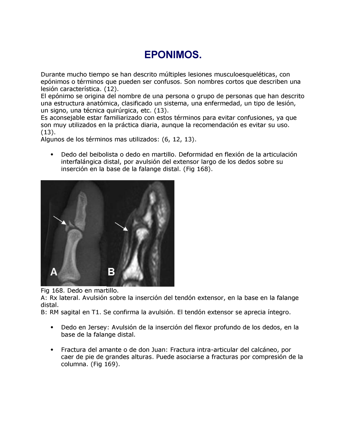 Eponimos de fracturas para aprender - EPONIMOS. Durante mucho tiempo se ...