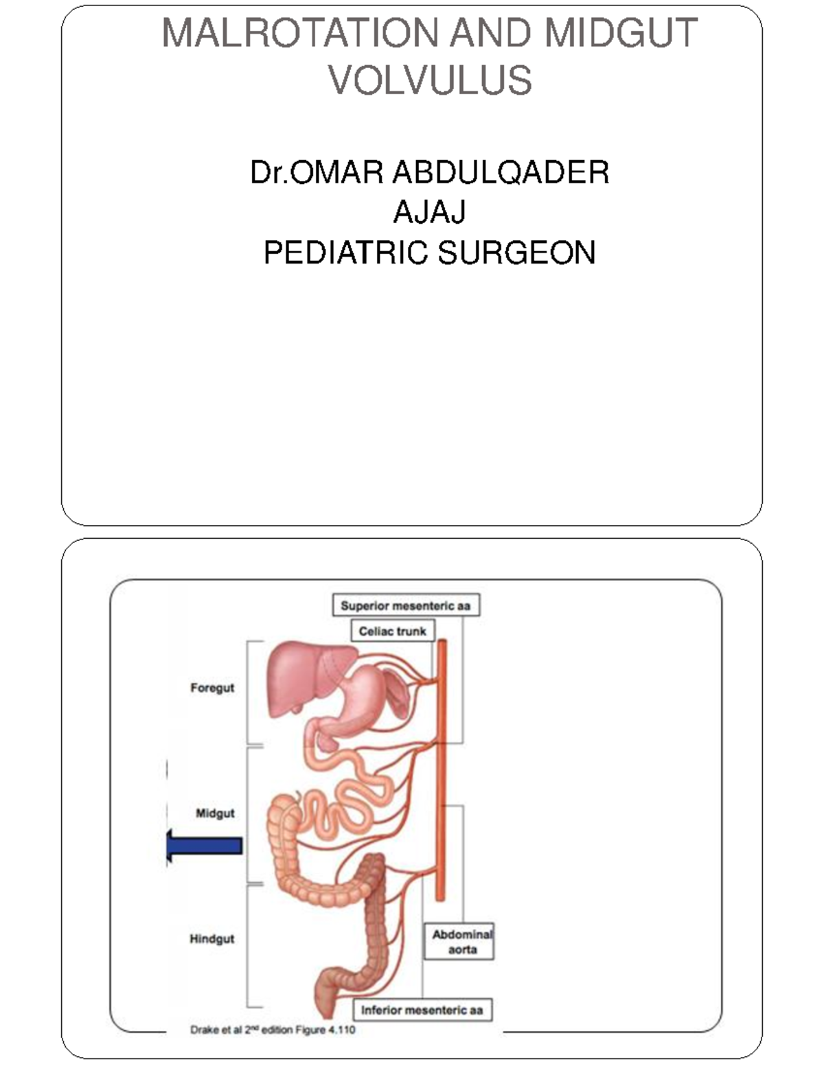 Malrotation And Midgut Volvulus Malrotation And Midgut Volvulus Dr Abdulqader Ajaj Pediatric 8792