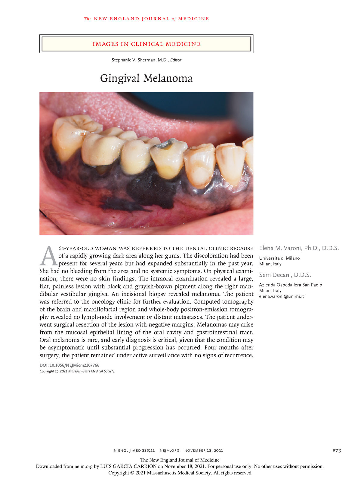 Gingival Melanoma Imagenes Nejm T H E N E W E Ng L A N D J O U R Na L O F M E Dic I N E N Engl 