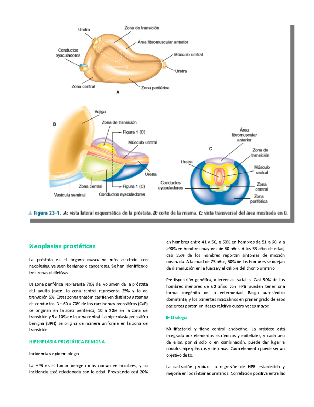cuando un tumor de próstata se considera vista grande