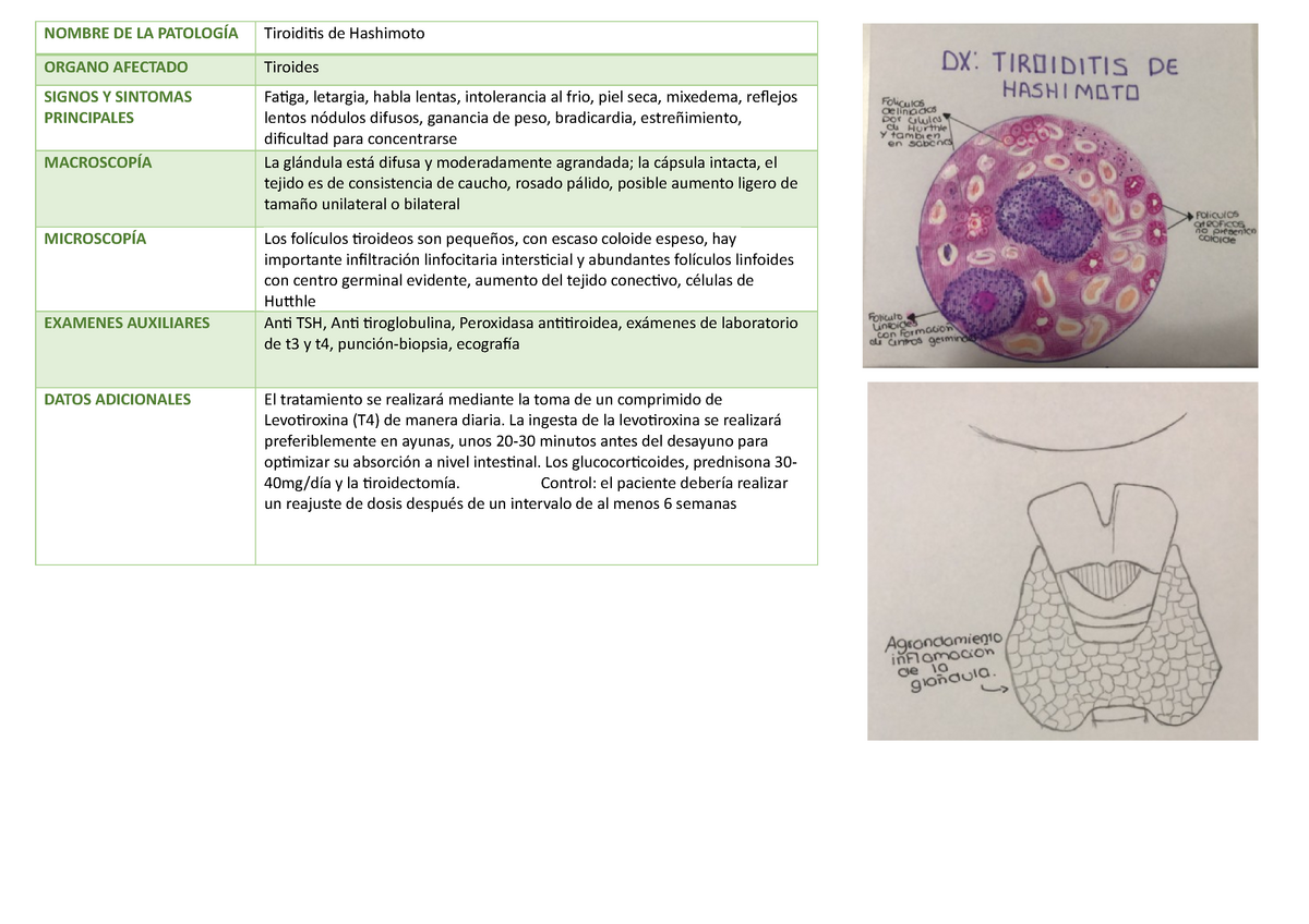 Tiroiditis De Hashimoto - Anatomiapatologica - UCSur - Studocu