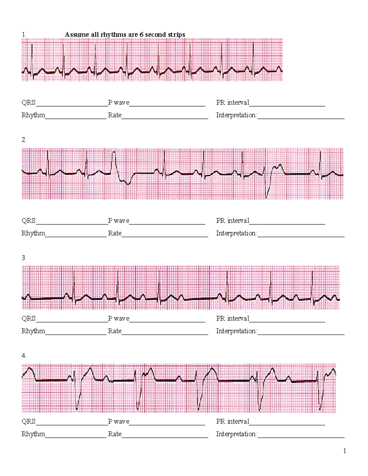 Cardiac Rhythm Strips Test Discount Www jkuat ac ke