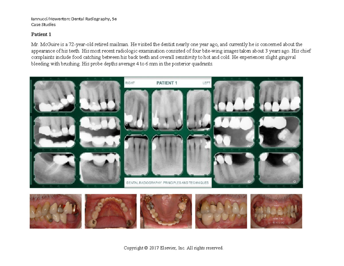 Patient 1 Questions and Images Iannucci/Howerton Dental Radiography