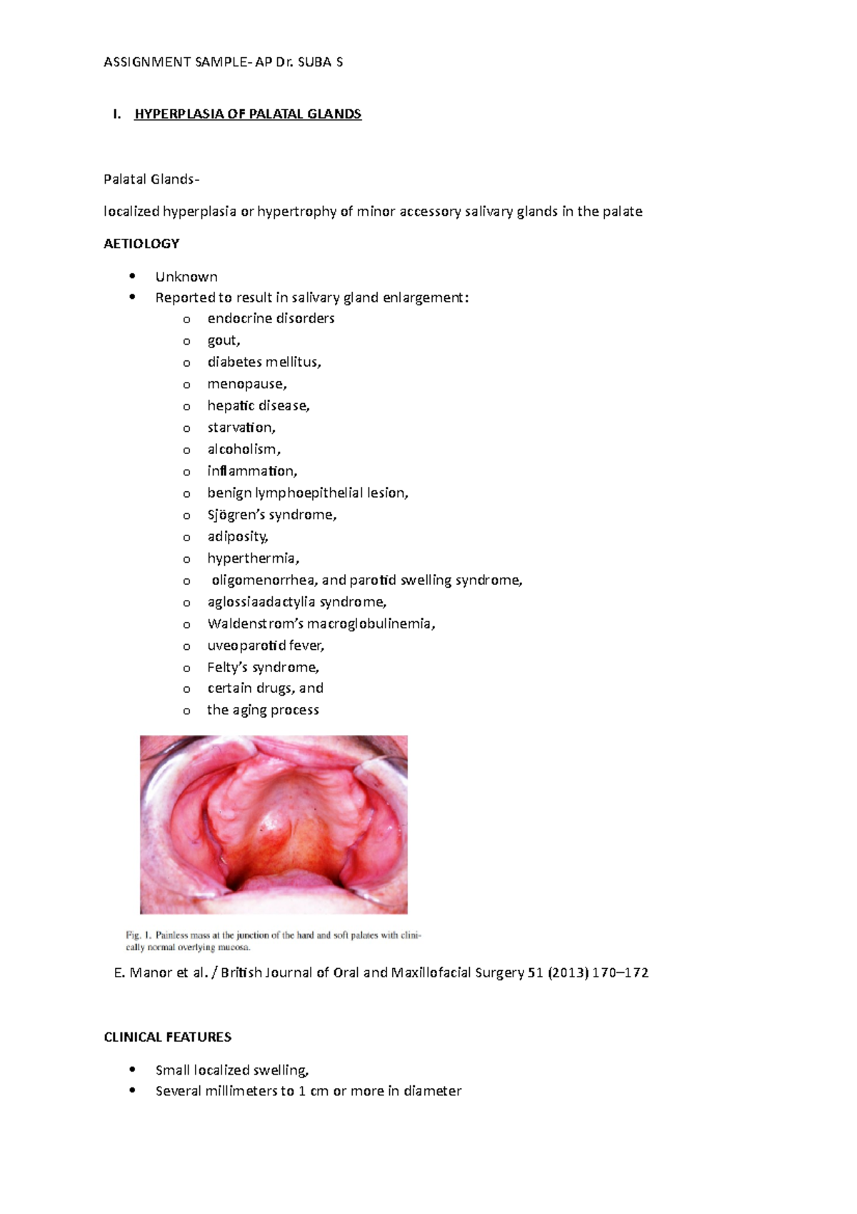 Assignment Sample I. HYPERPLASIA OF PALATAL GLANDS Palatal Glands