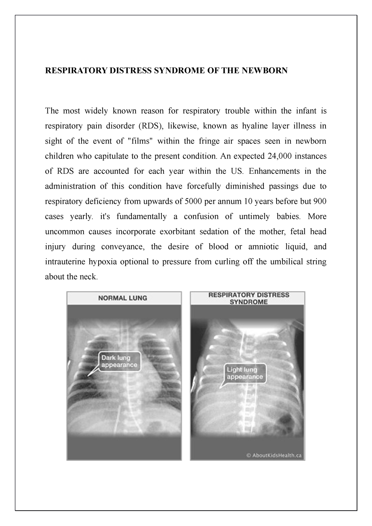 Respiratory Distress Syndrome OF THE Newborn - RESPIRATORY DISTRESS ...