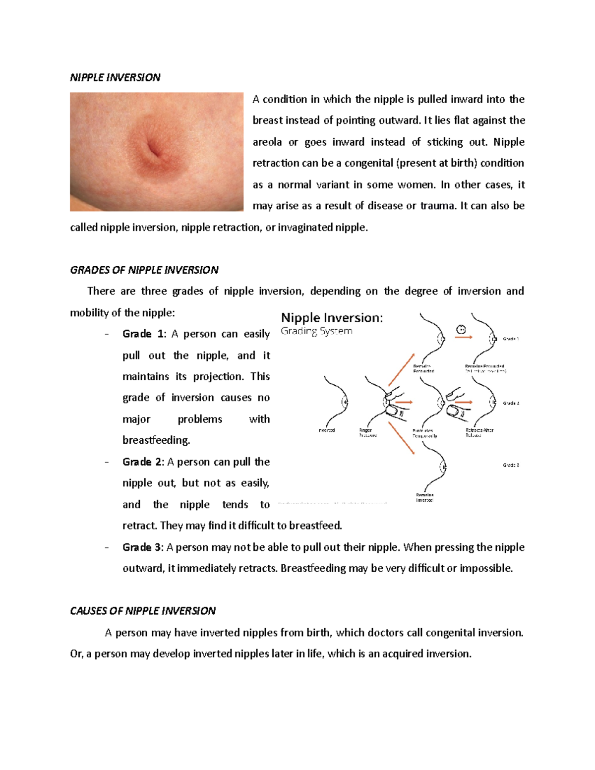 Nipple Inversion Nipple Inversion A Condition In Which The Nipple Is Pulled Inward Into The