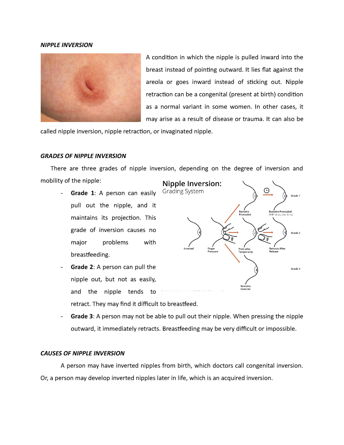 Nipple Inversion NIPPLE INVERSION A Condition In Which The Nipple Is 