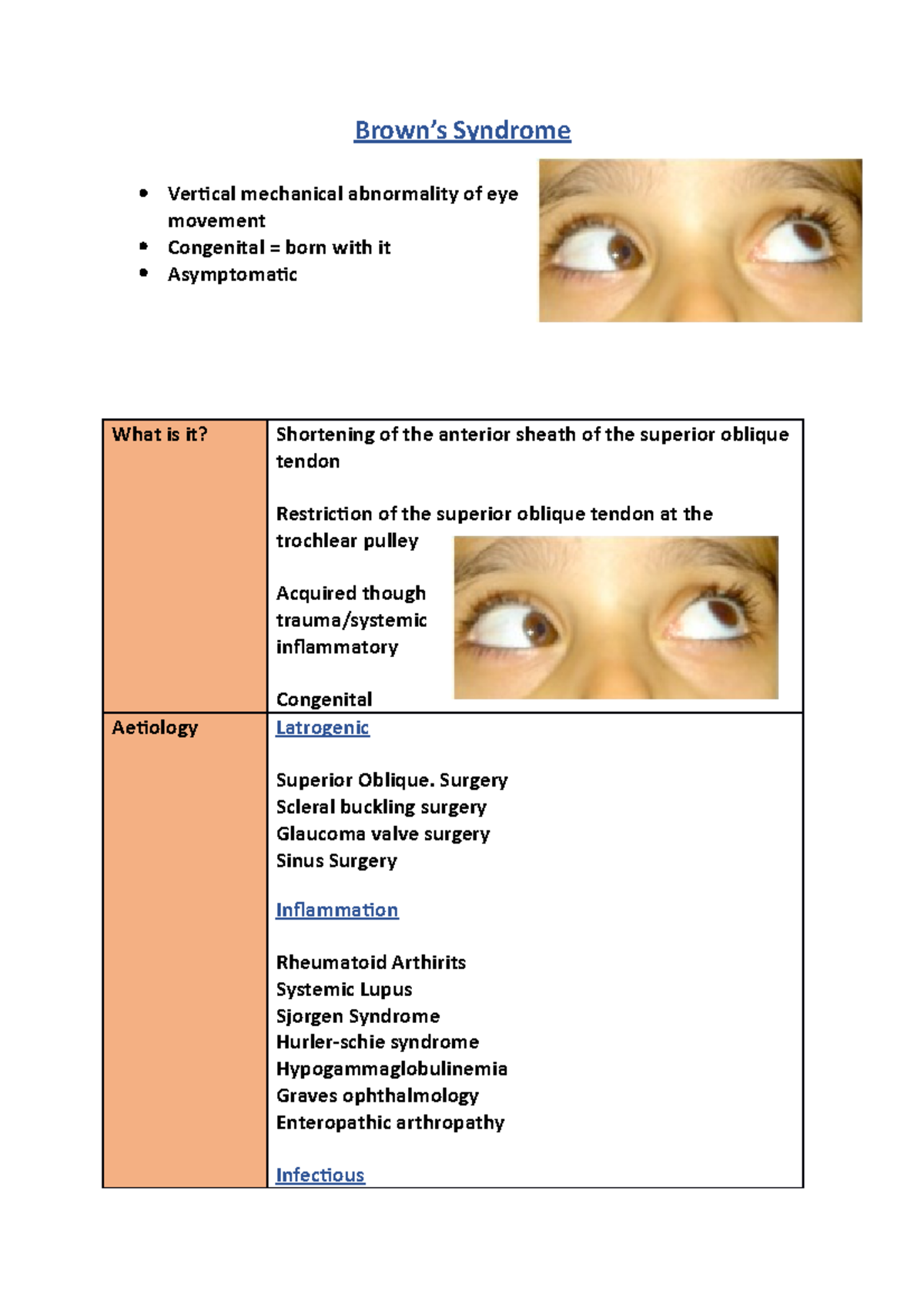 Brown Syndrome - N A - Brown’s Syndrome Vertical Mechanical Abnormality 