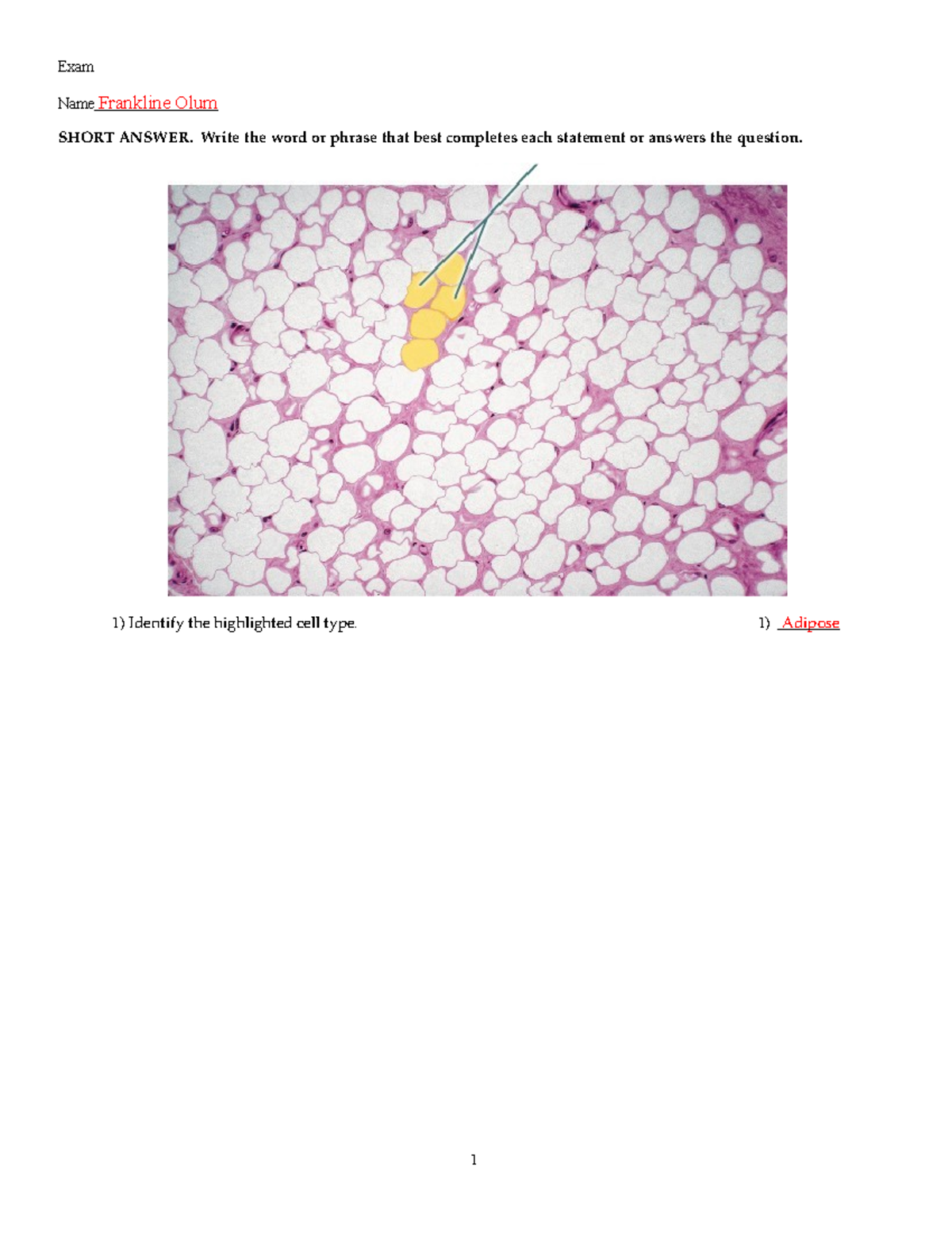 Unit 1 Lab Exam - Bones - Exam Name Frankline Olum SHORT ANSWER. Write ...