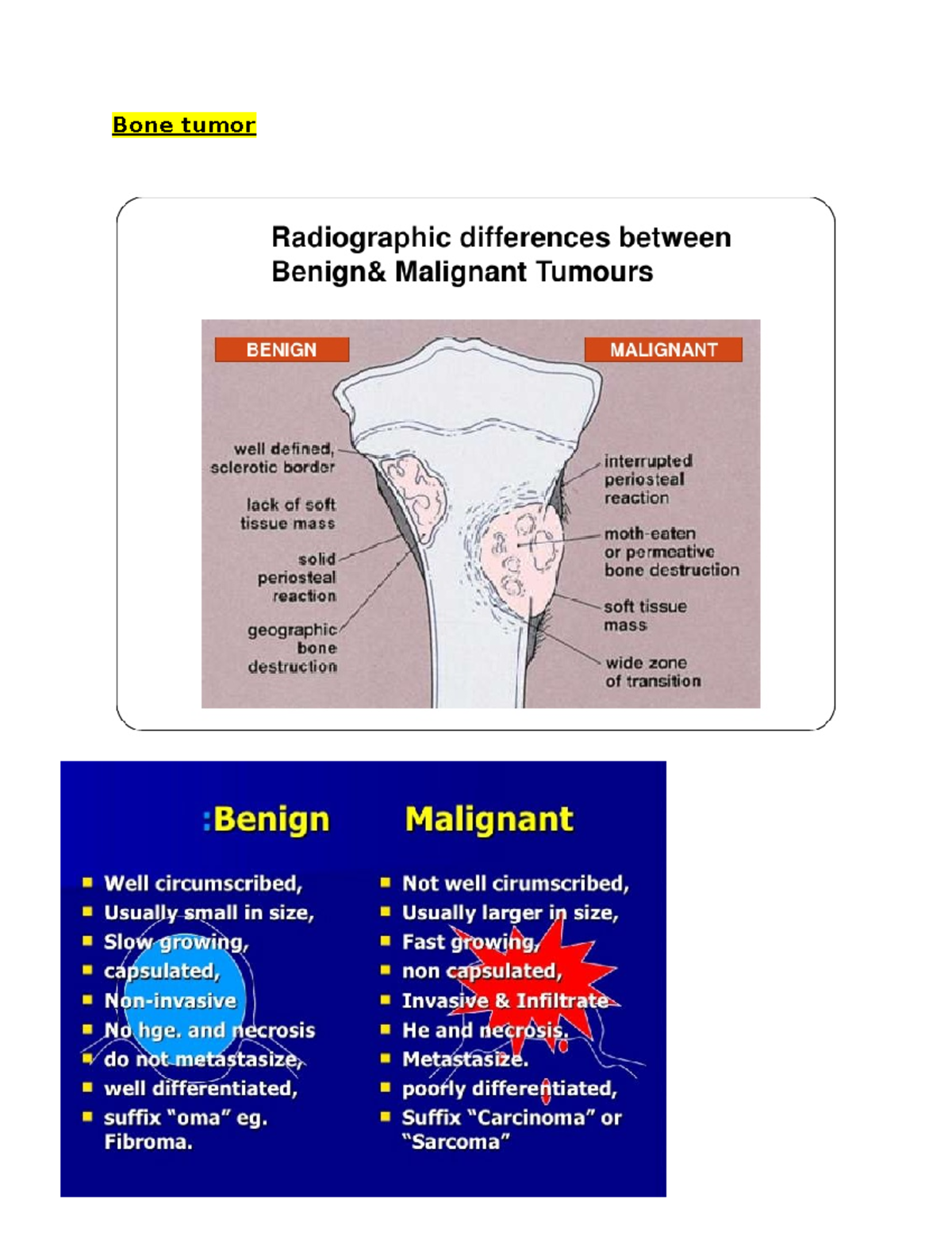 Presentation on Bone Tumors - Bone tumor - Studocu