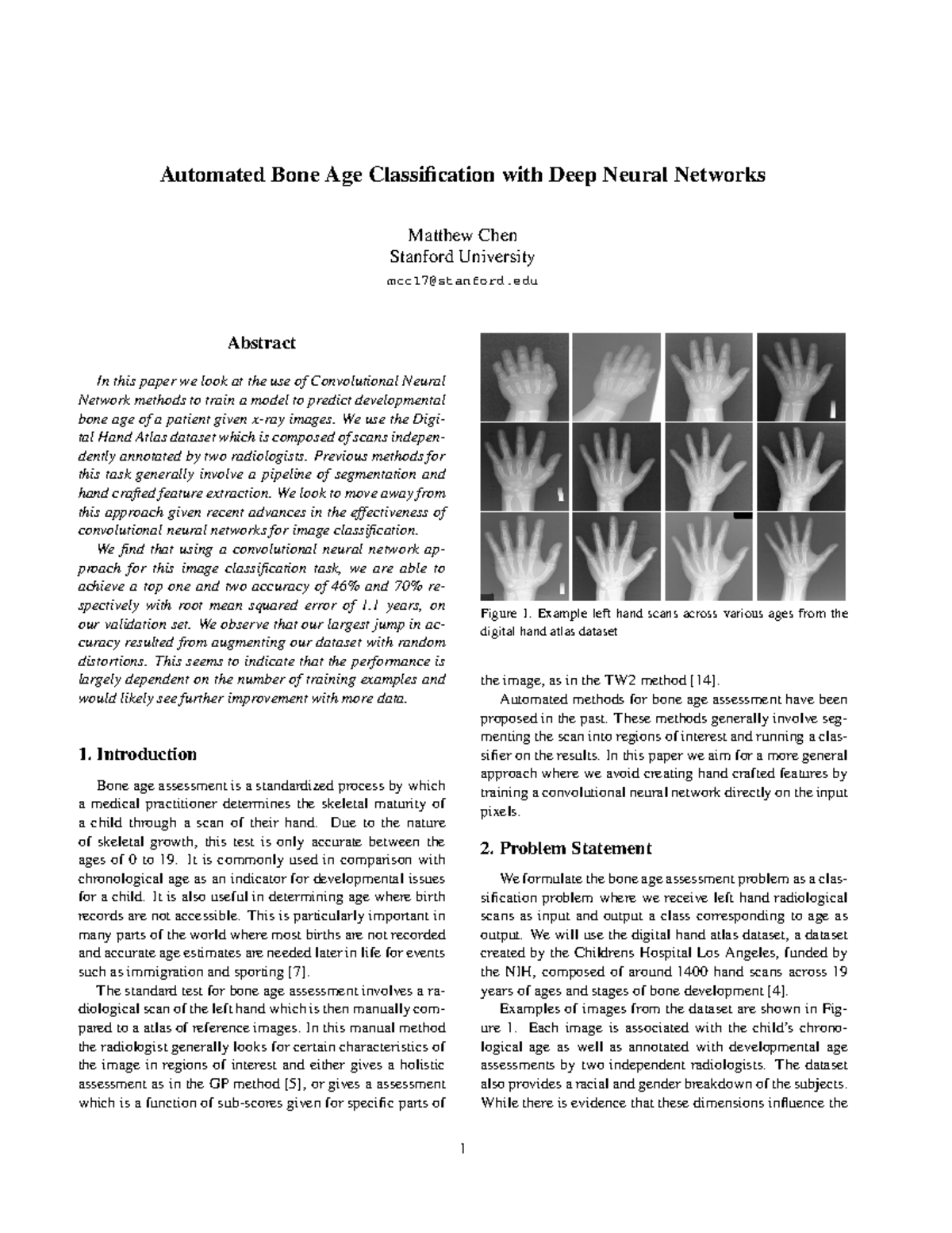 automated-bone-age-classification-with-deep-neural-networks-automated