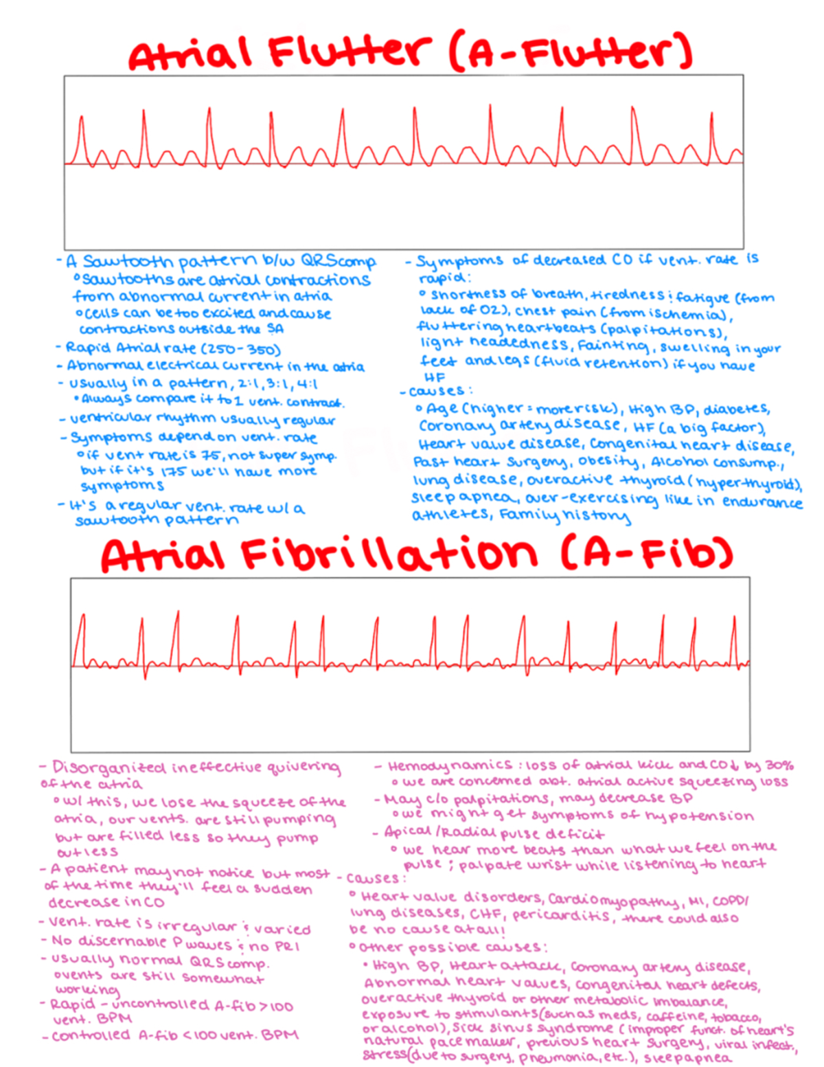 A flutter:a fib - These are helpful study guides to differentiate ...