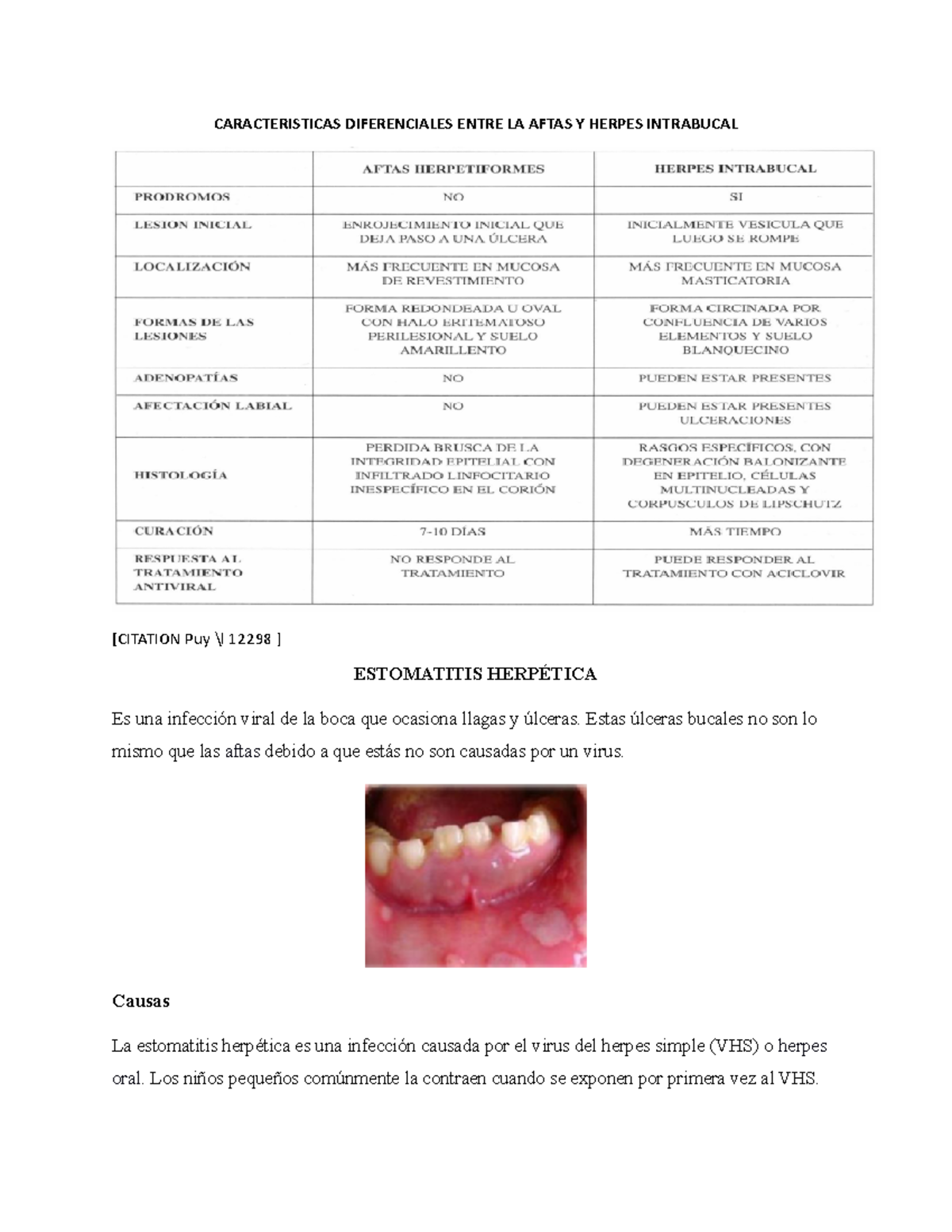 Herpes Intraoral de internado del grupo CARACTERISTICAS DIFERENCIALES ENTRE LA AFTAS Y HERPES