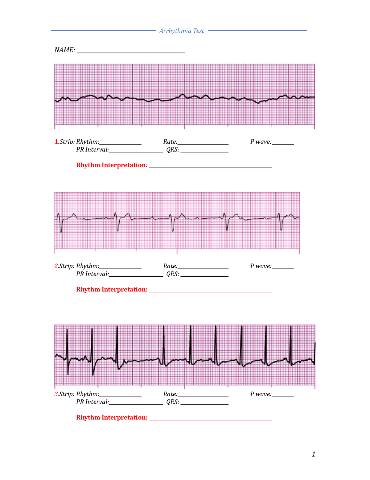 1. Arrythmia worksheet 1 (1) - NAME: 1 .Strip: Rhythm: Rate: P wave: PR ...