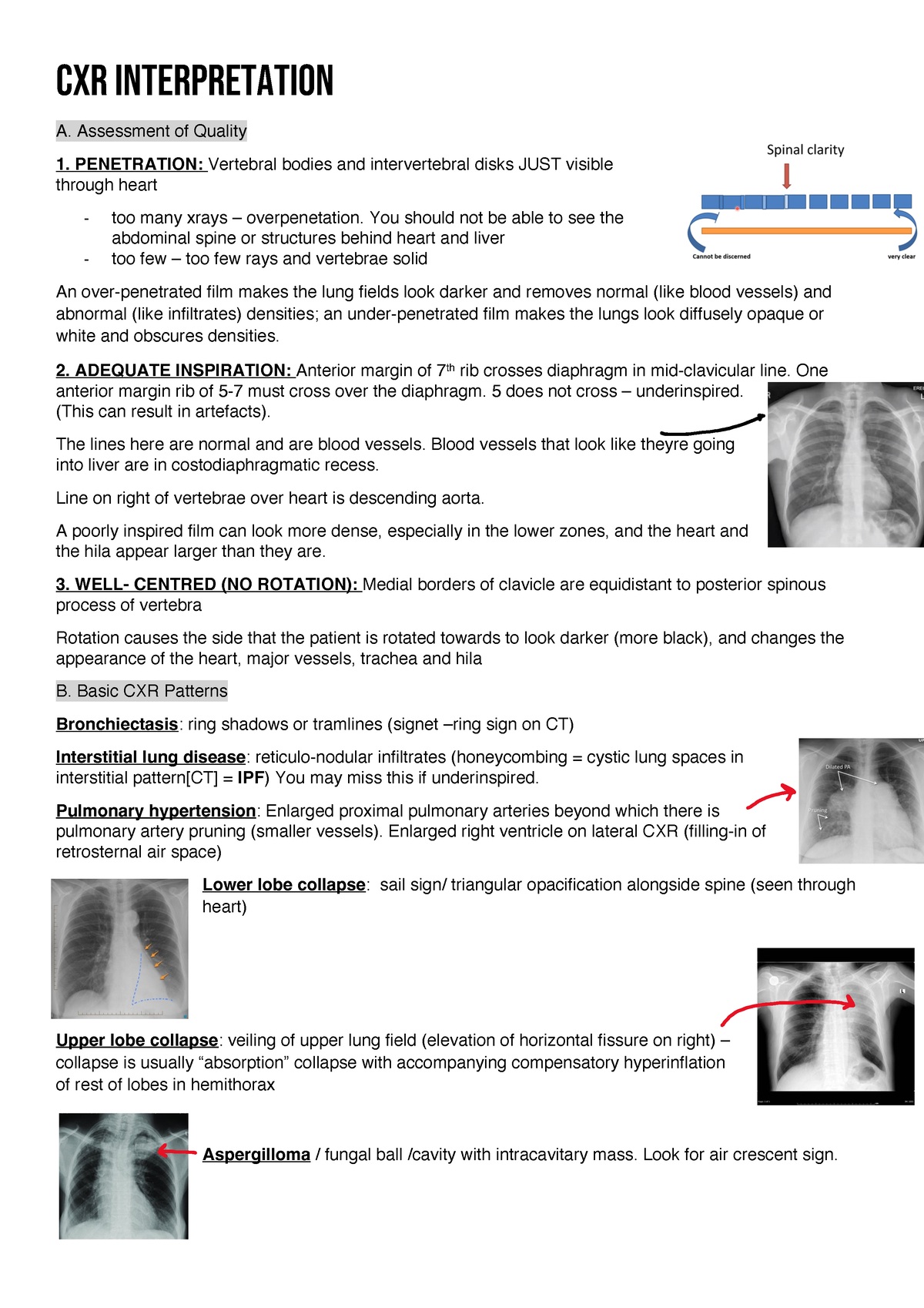 Chest imaging using signs, symbols, and naturalistic images: a practical  guide for radiologists and non-radiologists | Insights into Imaging | Full  Text