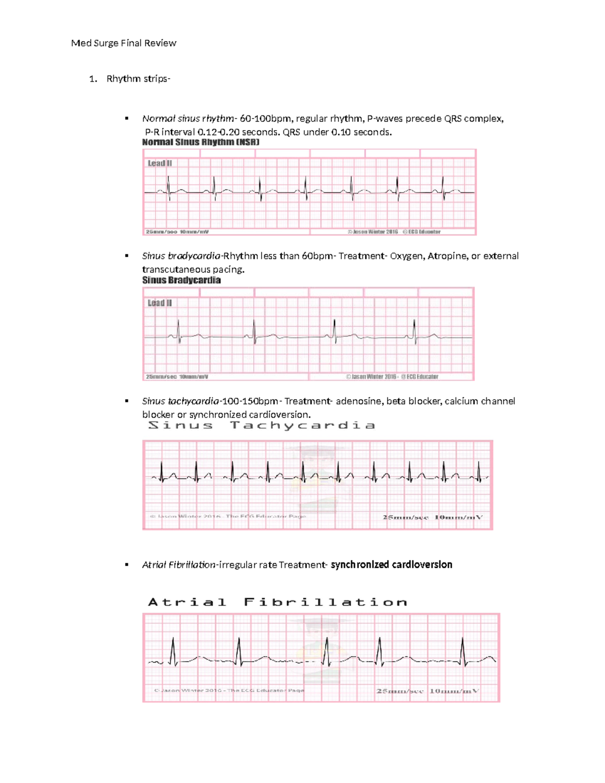 Review final Med Surge - notes - Rhythm strips- Normal sinus rhythm- 60 ...