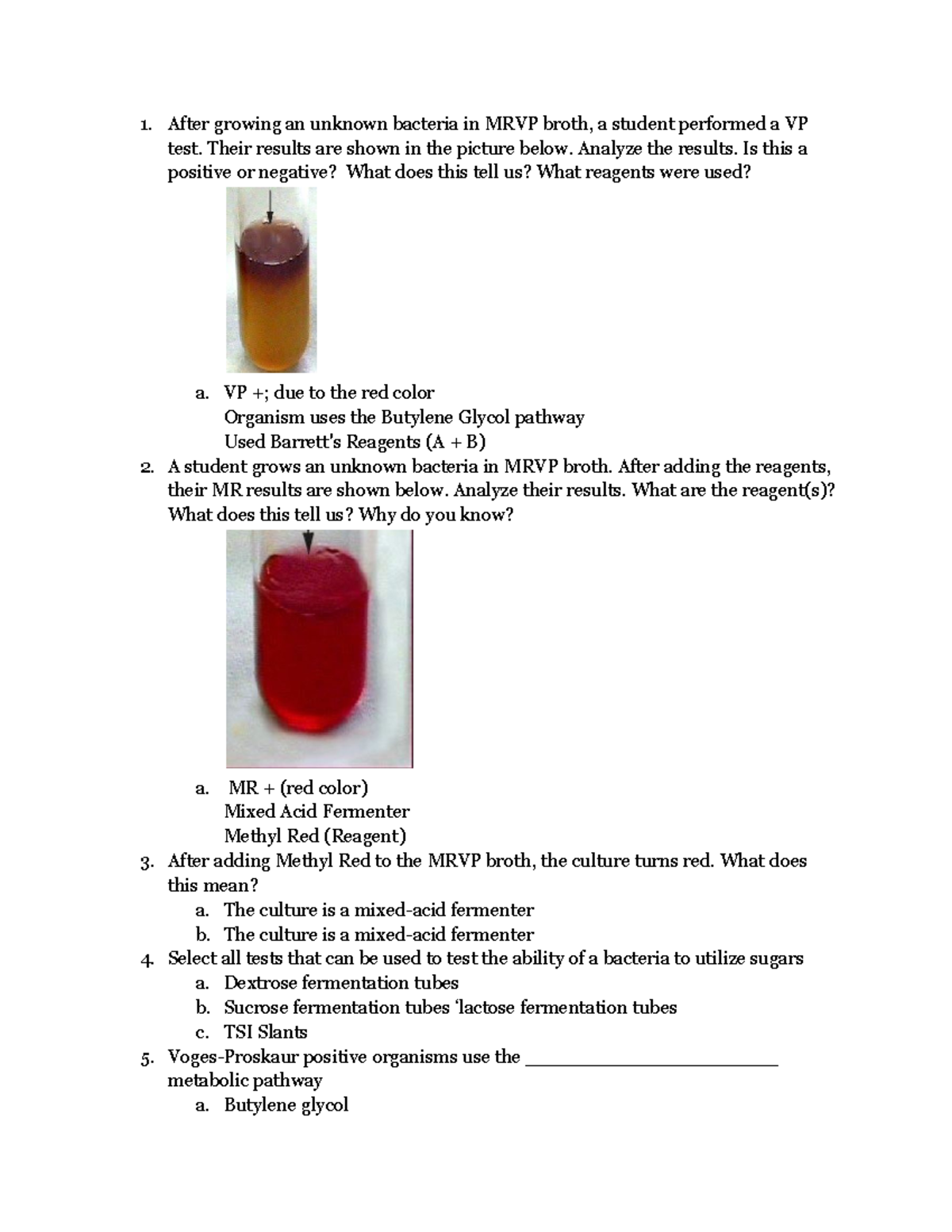 microbiology-lab-quiz-7-after-growing-an-unknown-bacteria-in-mrvp