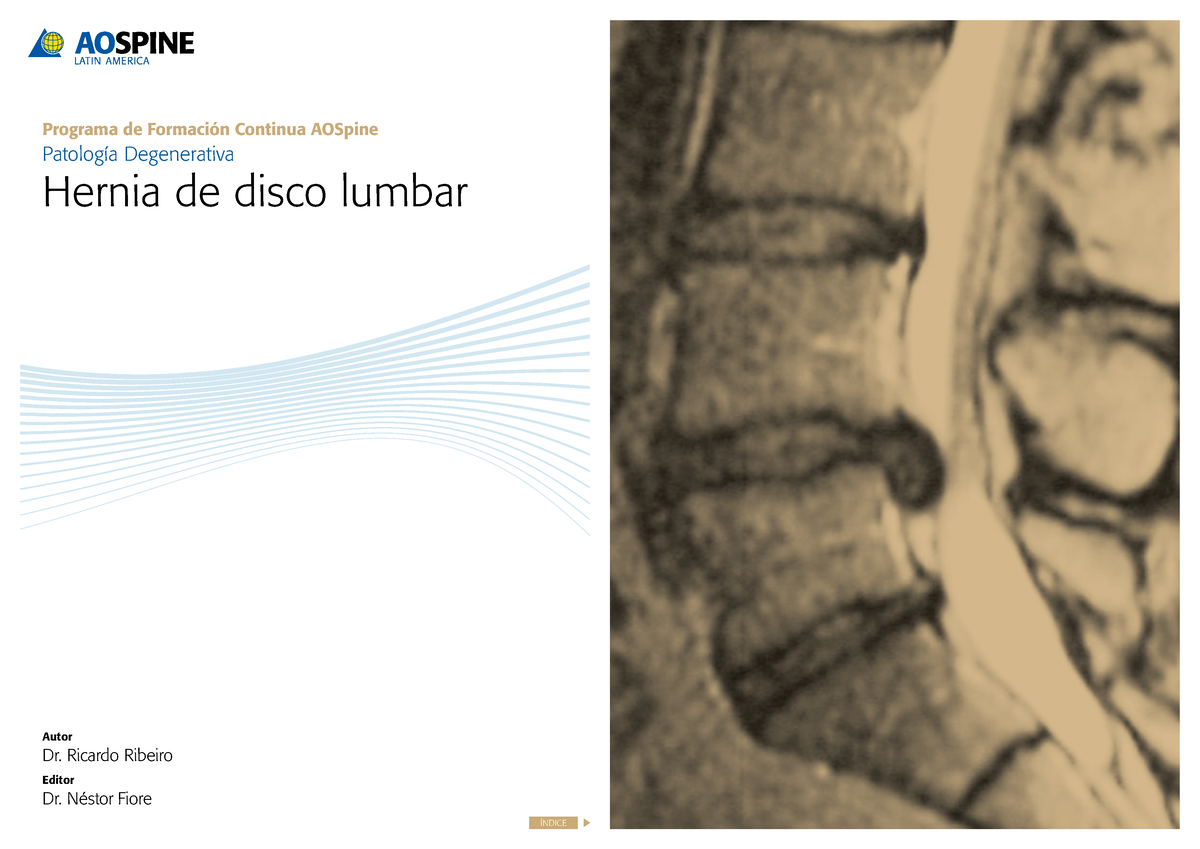 Hernia Discal Lumbar - Programa De Formación Continua AOSpine Patología ...