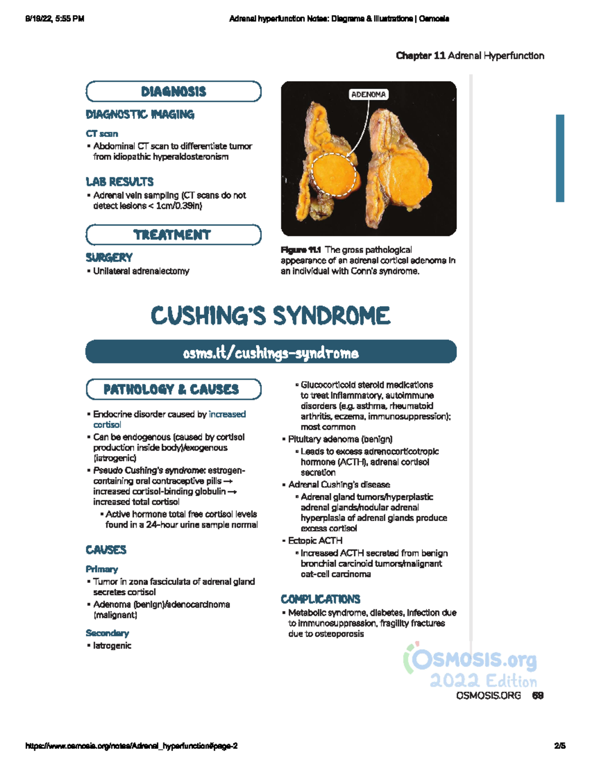 Cushing syndrome - NUR 206 - Studocu