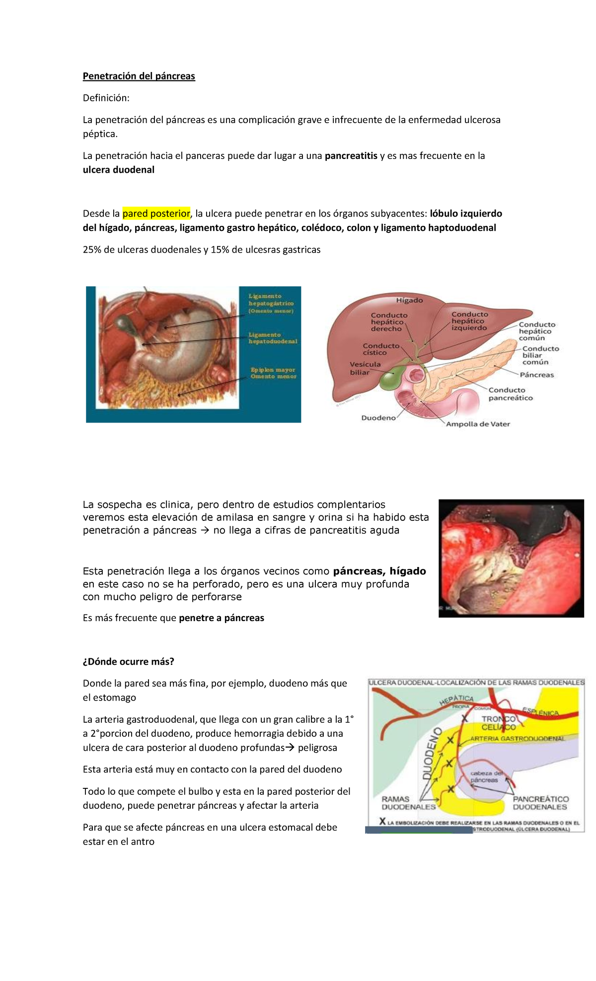 Penetración Del Páncreas - PenetraciÛn Del P·ncreas DefiniciÛn: La ...