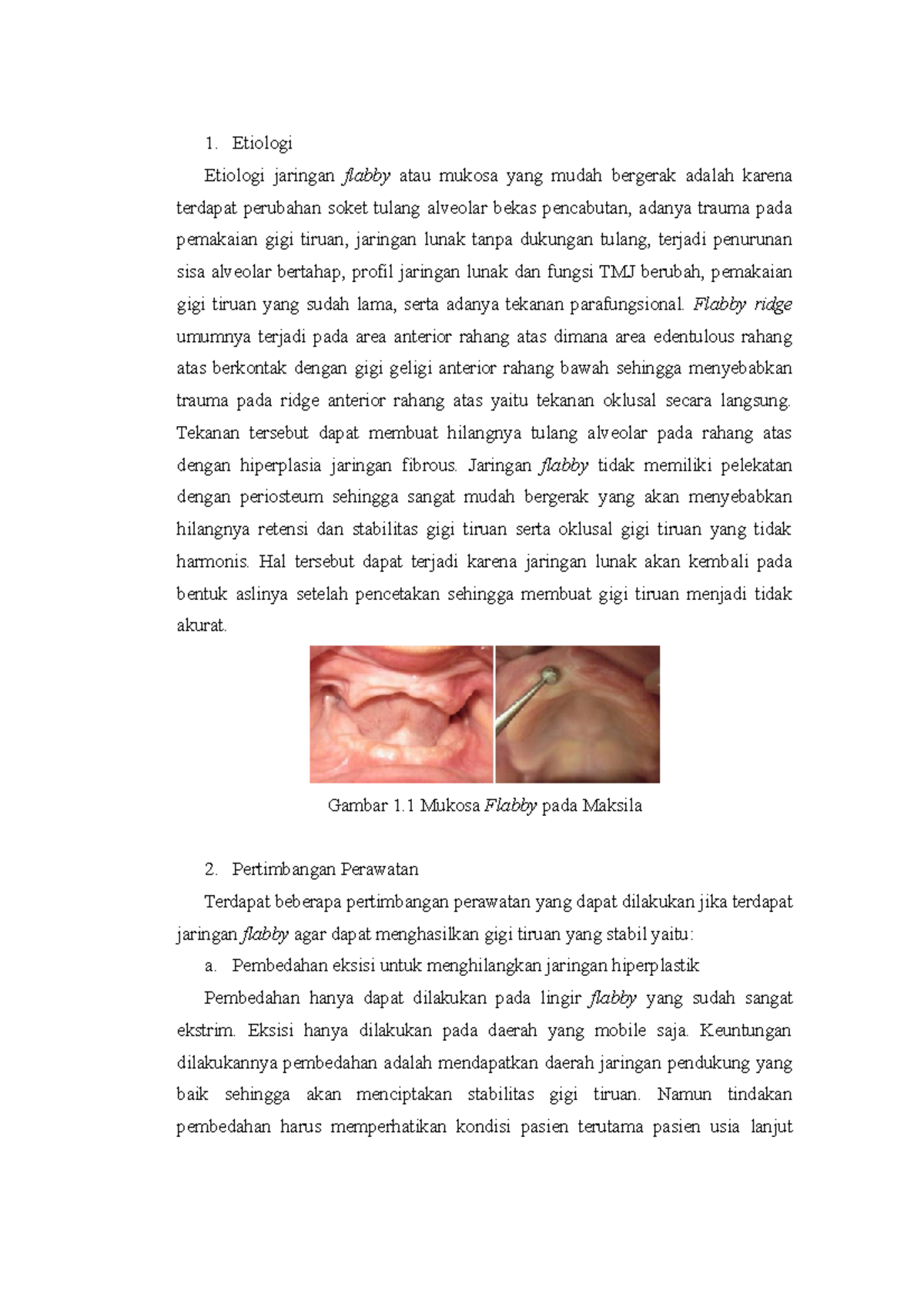 flabby-tissue-etiologi-etiologi-jaringan-flabby-atau-mukosa-yang