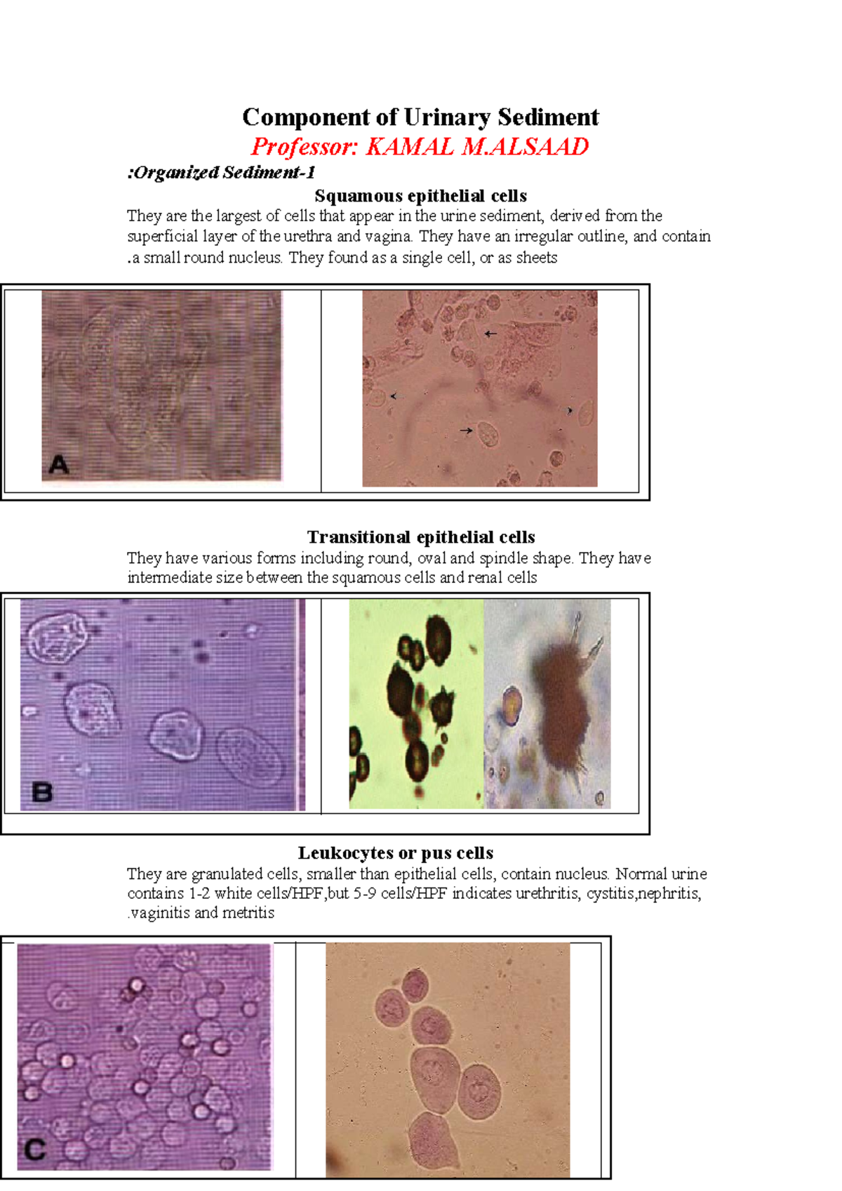 Componentof Urinary Sediment 1111111 - Component of Urinary Sediment ...