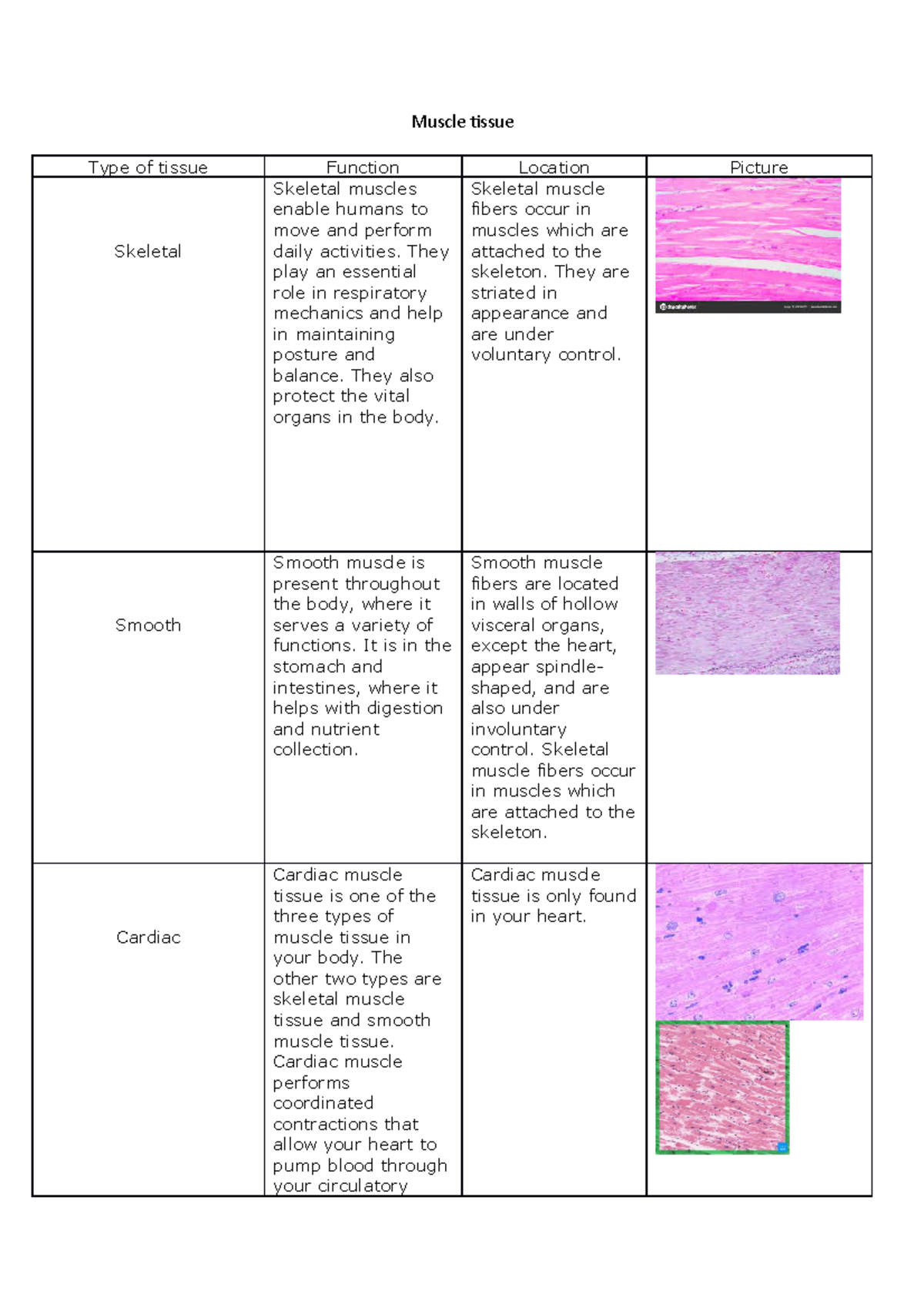 Muscle tissue histo - Muscle tissue Type of tissue Function Location ...