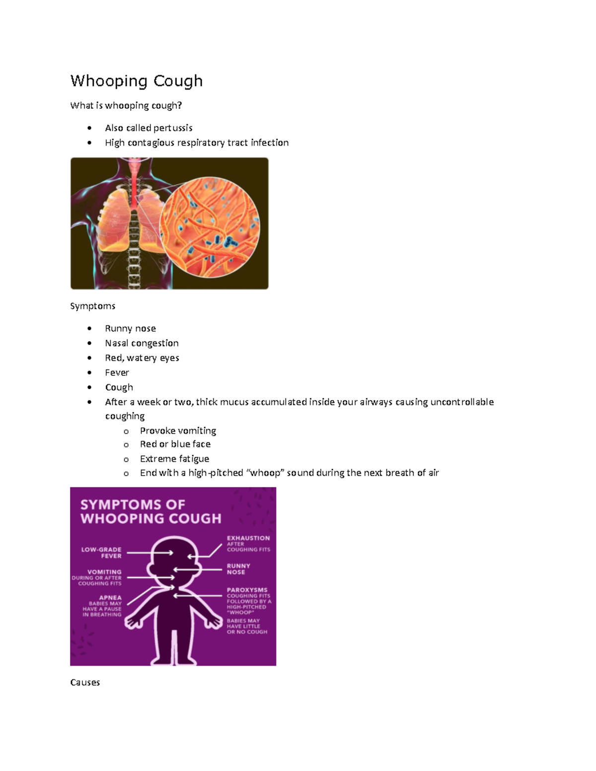 Whooping Cough Whooping Cough What is whooping cough? Also called