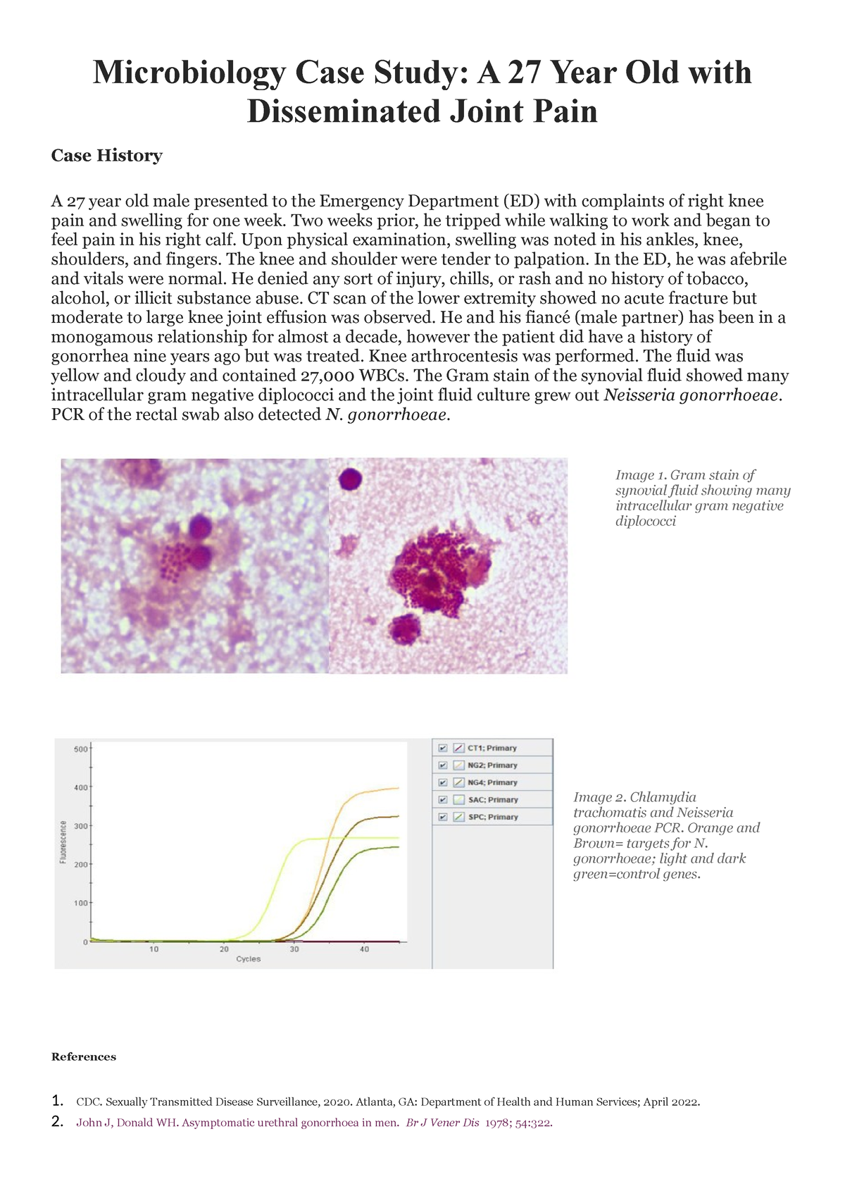 microbiology patient case study