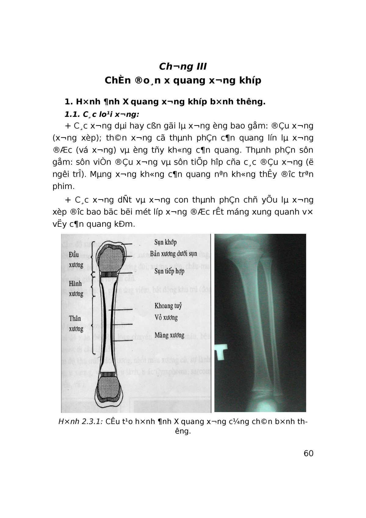 XQ Benh ly xuong khop Chng III ChÈn o n x quang xng khíp Hnh nh X quang xng khíp bnh