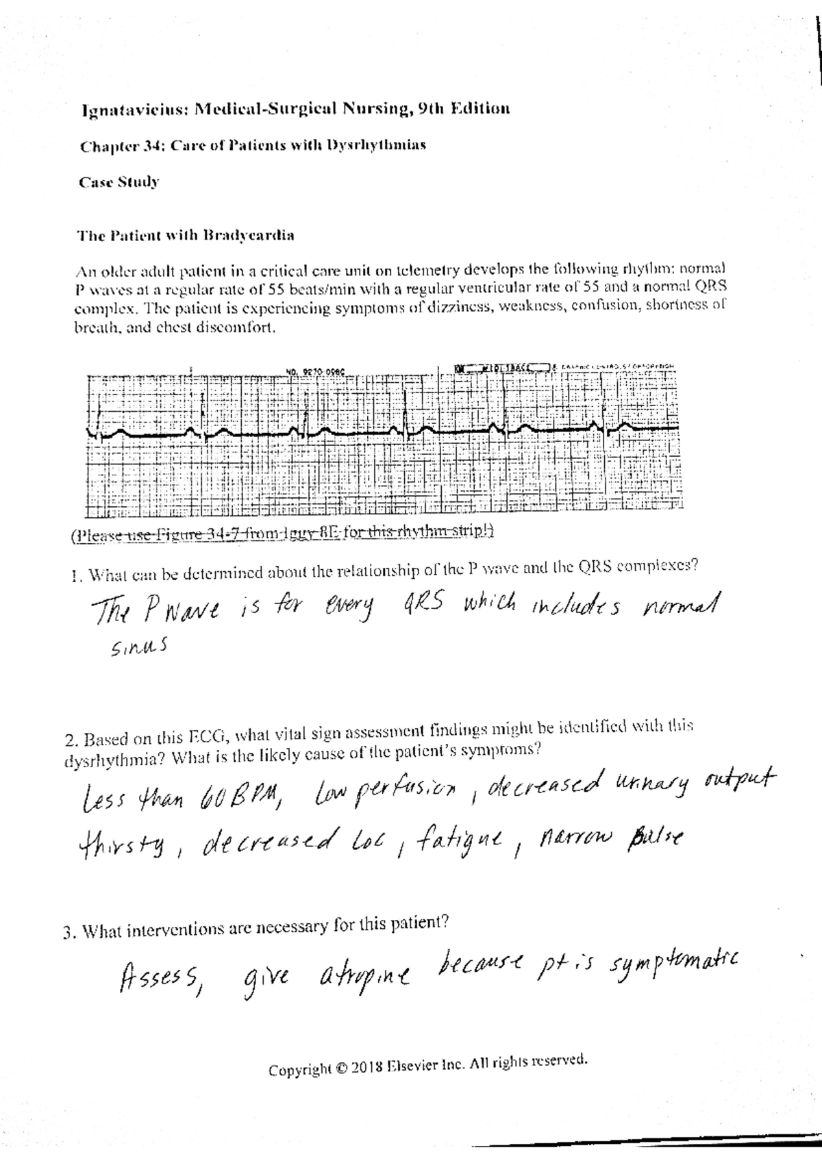 bradycardia-study-case-nurs223-studocu