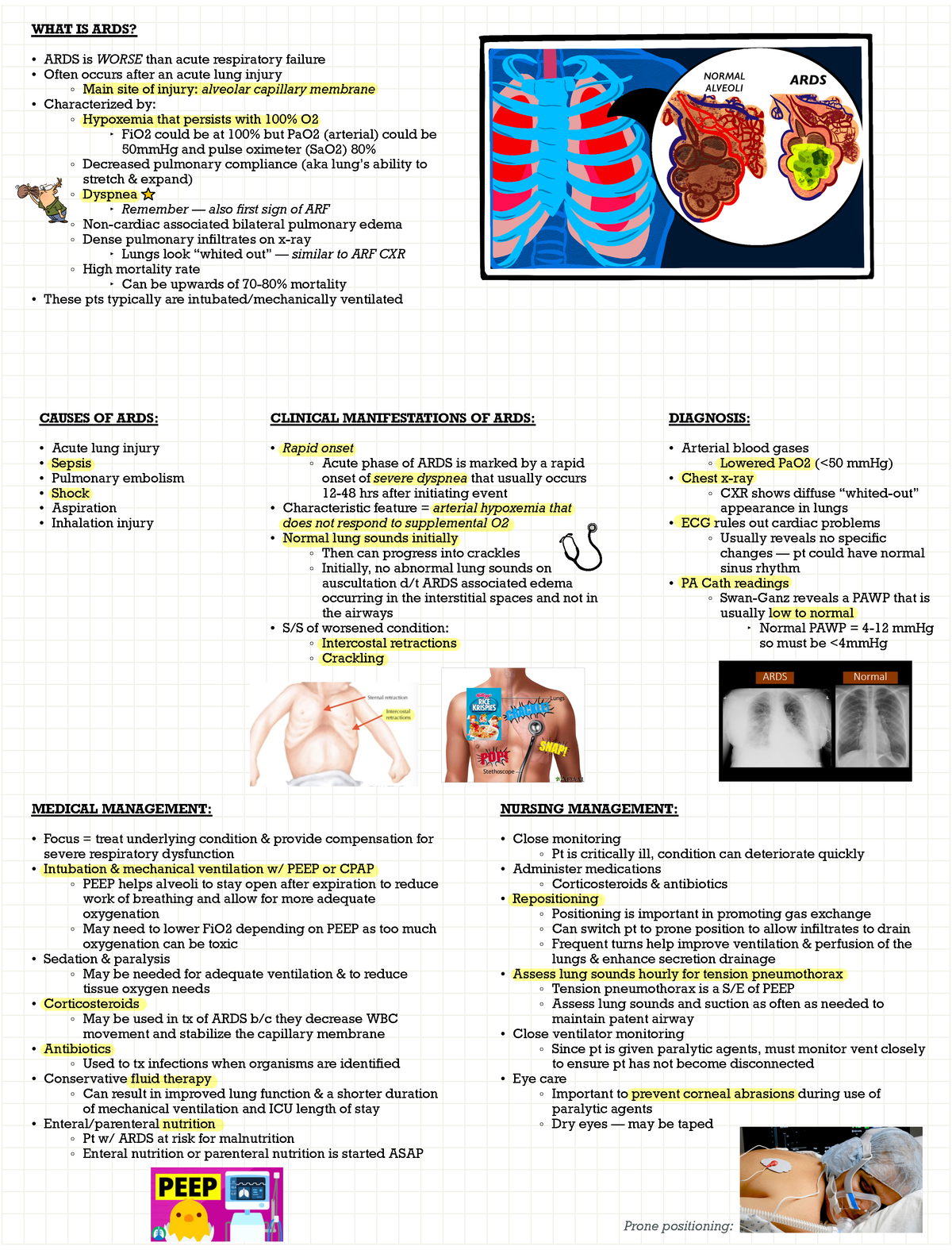 ARDS (Acute Respiratory Distress Syndrome) - WHAT IS ARDS? ARDS is ...