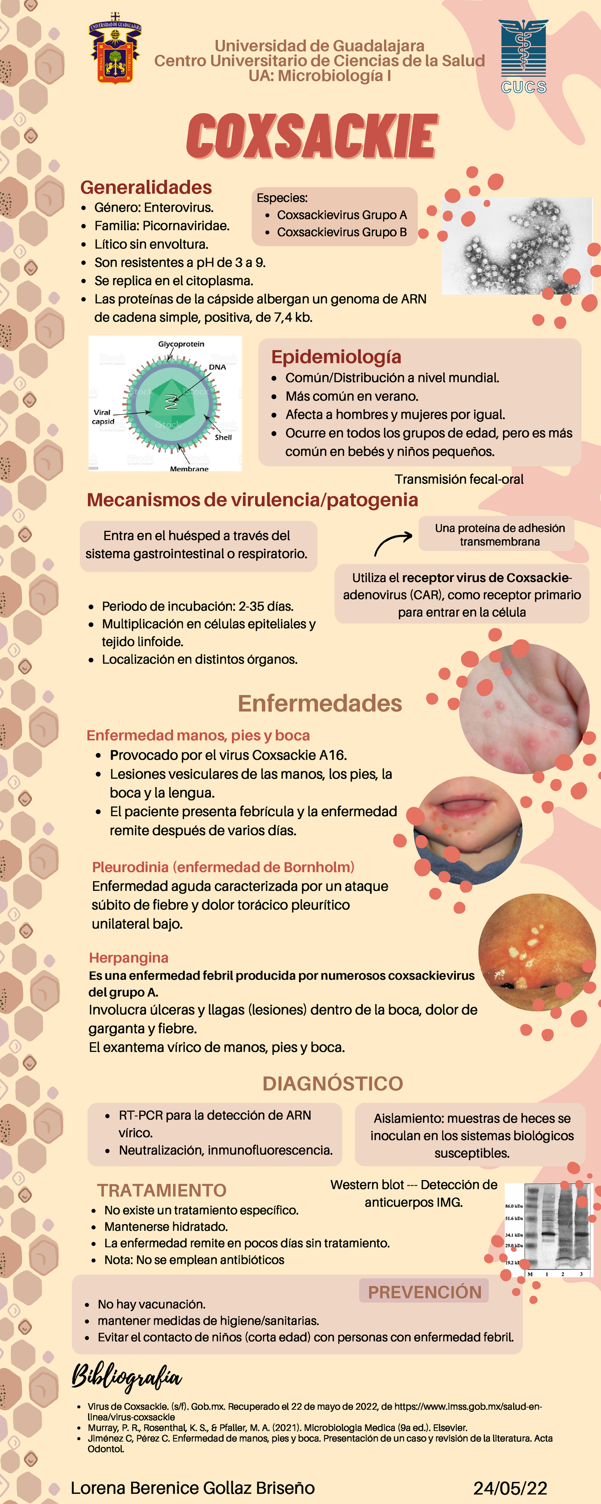 Coxsackie Virus Universidad de Guadalajara Centro Universitario de Ciencias de la Salud UA