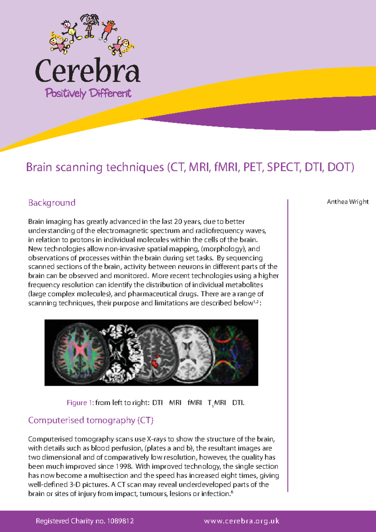 Brain scanning techniques - © Cerebra 2009 Background Brain imaging has ...