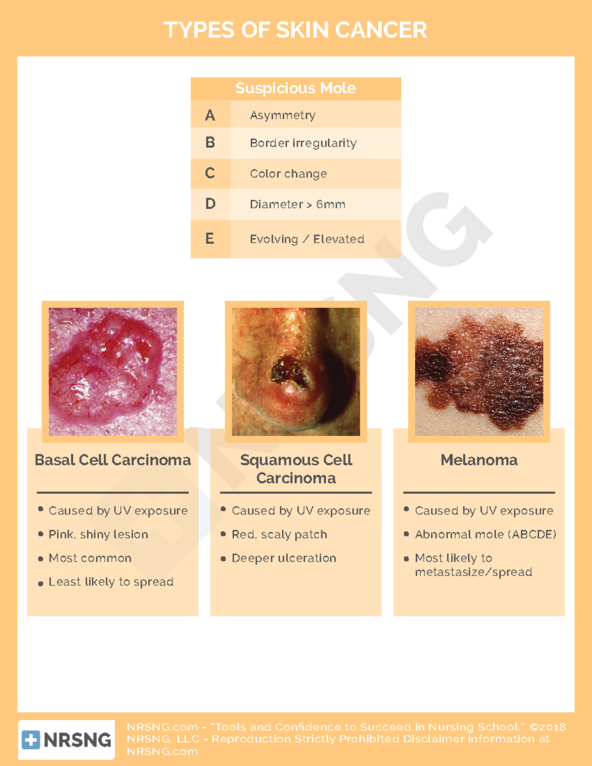 Cs-integ-003-types of skin cancer - NRSNG - “Tools and Con dence to ...