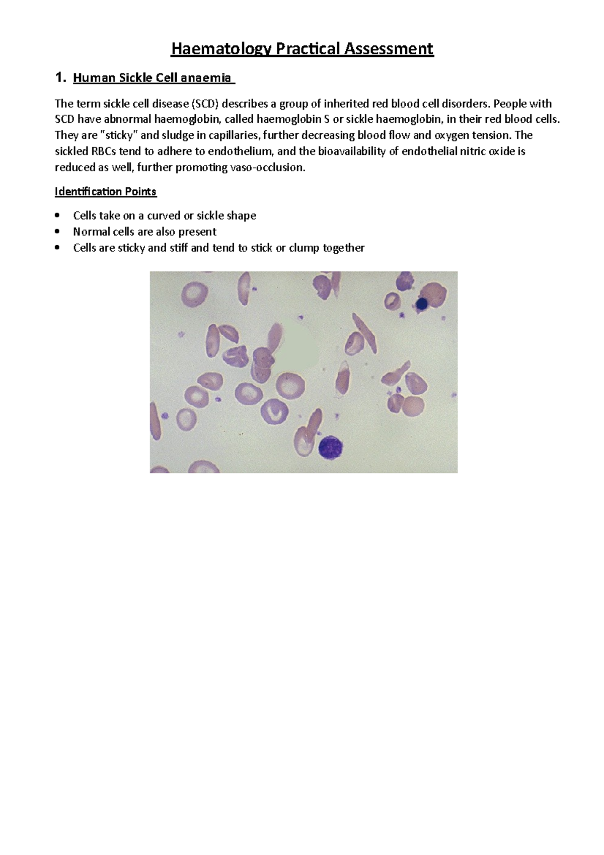 Haematology Practical Assessment - Human Sickle Cell anaemia The term ...