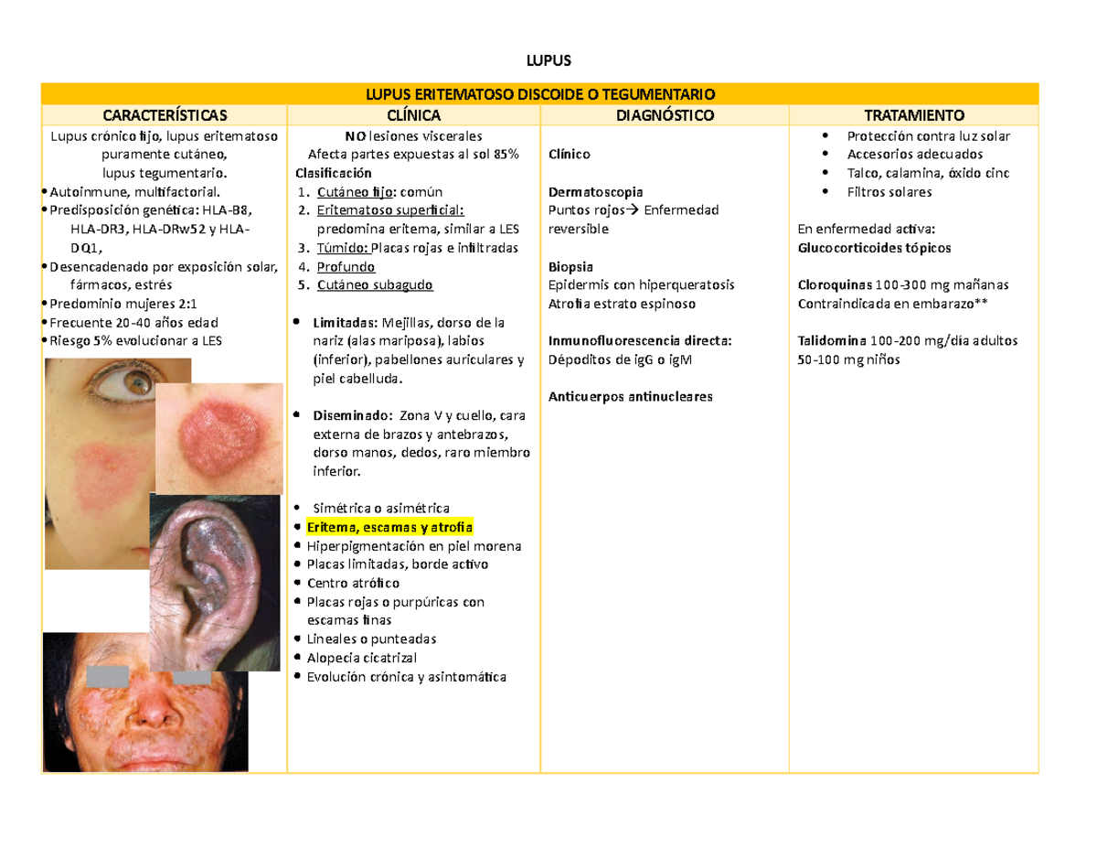 Lupus Caracter Sticas Clinica Tratamiento Lupus Lupus Eritematoso