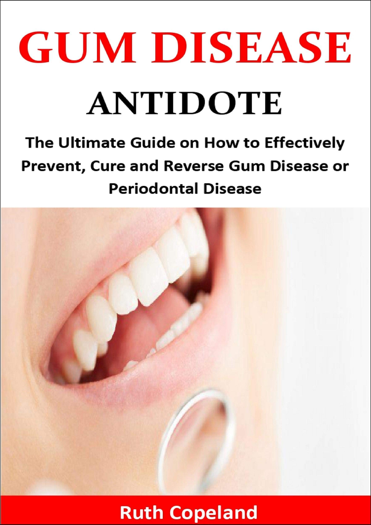 Read PDF Gum Disease Antidote: The Ultimate Guide On How To Effectively ...