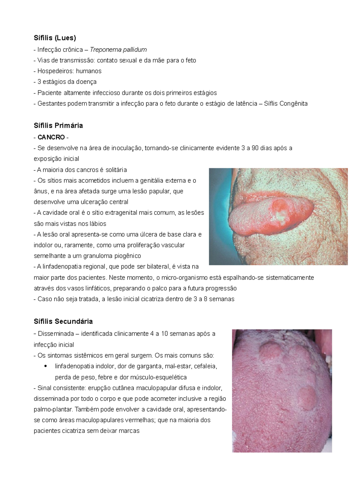 Sifilis - Patologia Oral e Maxilofacial - Sífilis (Lues) Infecção ...
