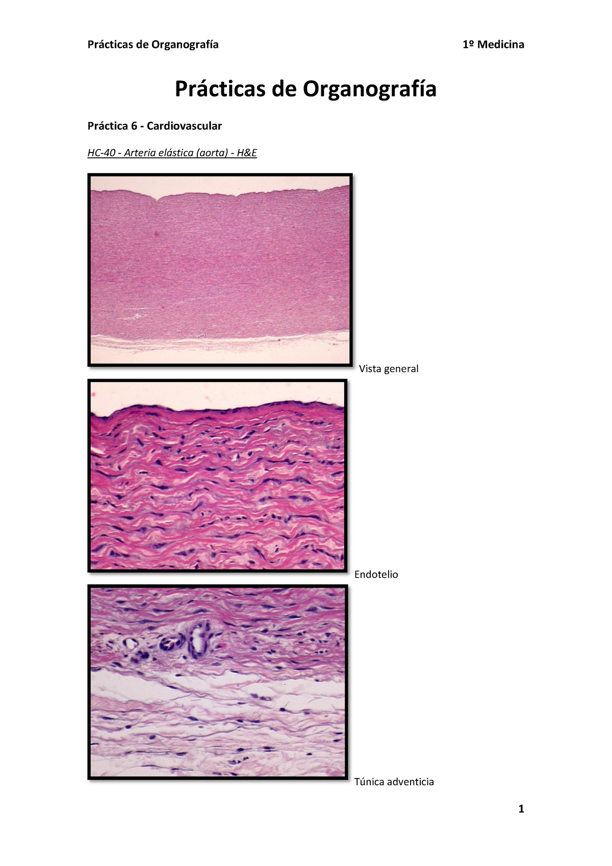 portaobjetos de histología de la aorta