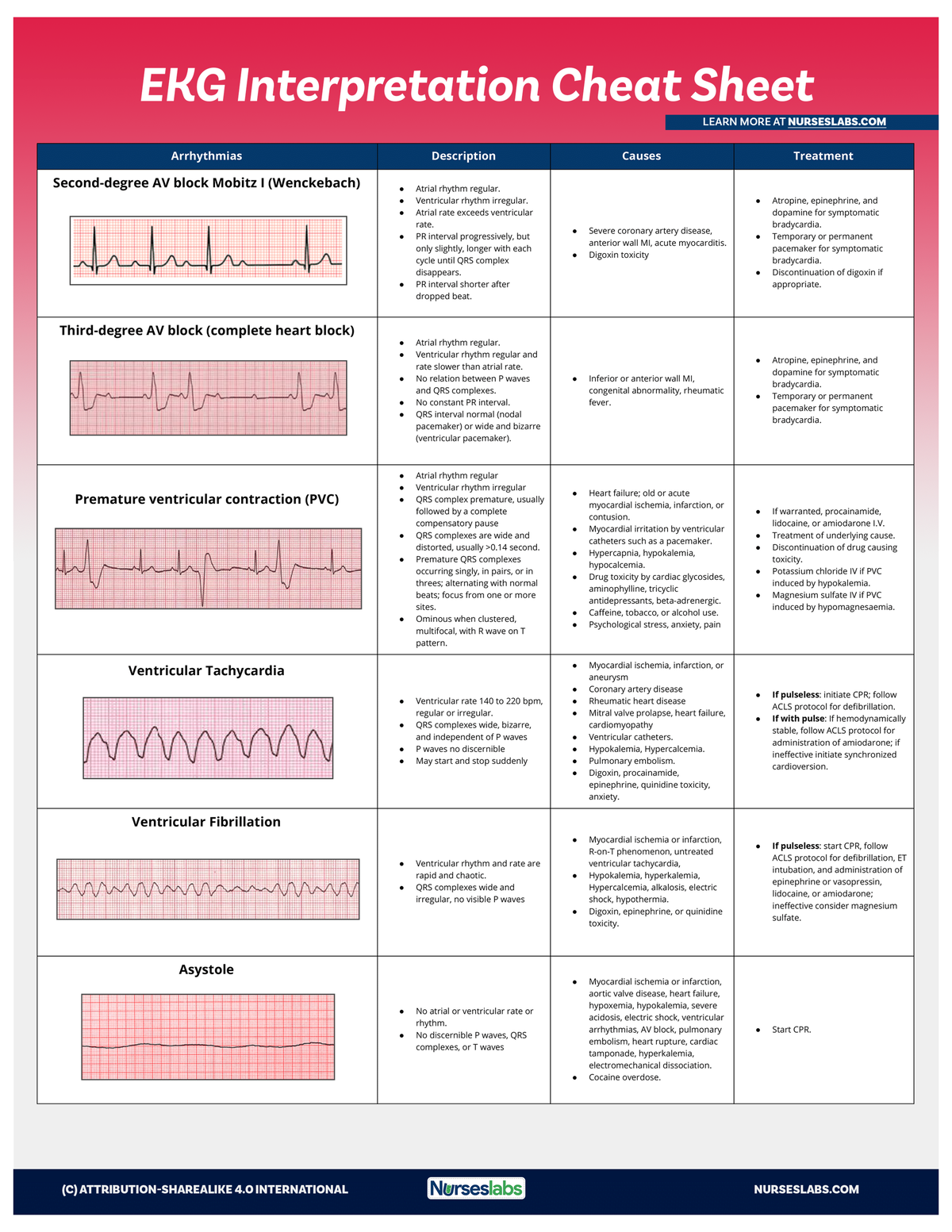 EKG-Interpretation-Cheat-Sheet-for-Heart-Arrhythmias Nurseslabs 3 ...