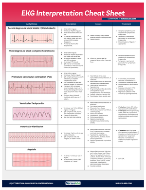 EKG-Interpretation-Cheat-Sheet-for-Heart-Arrhythmias Nurseslabs 2 ...