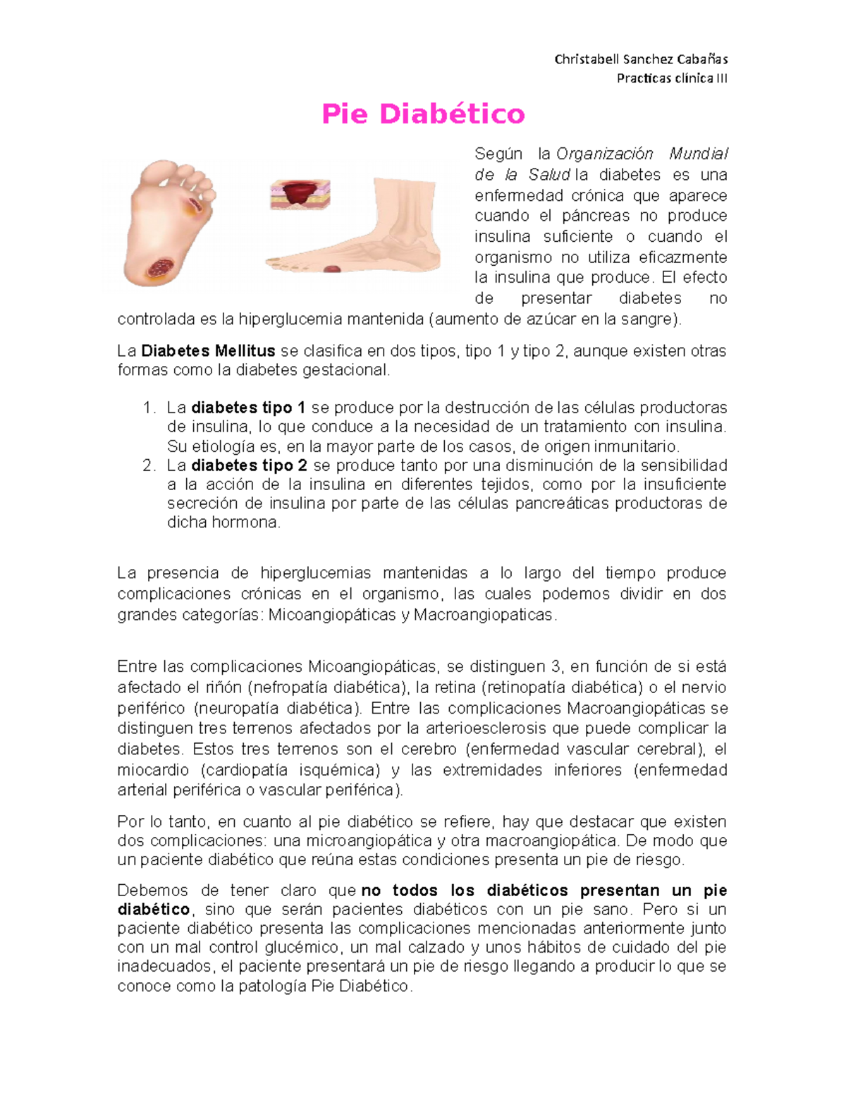 Pie Diabético es un resumen de apuntes de pie diabetico Practicas