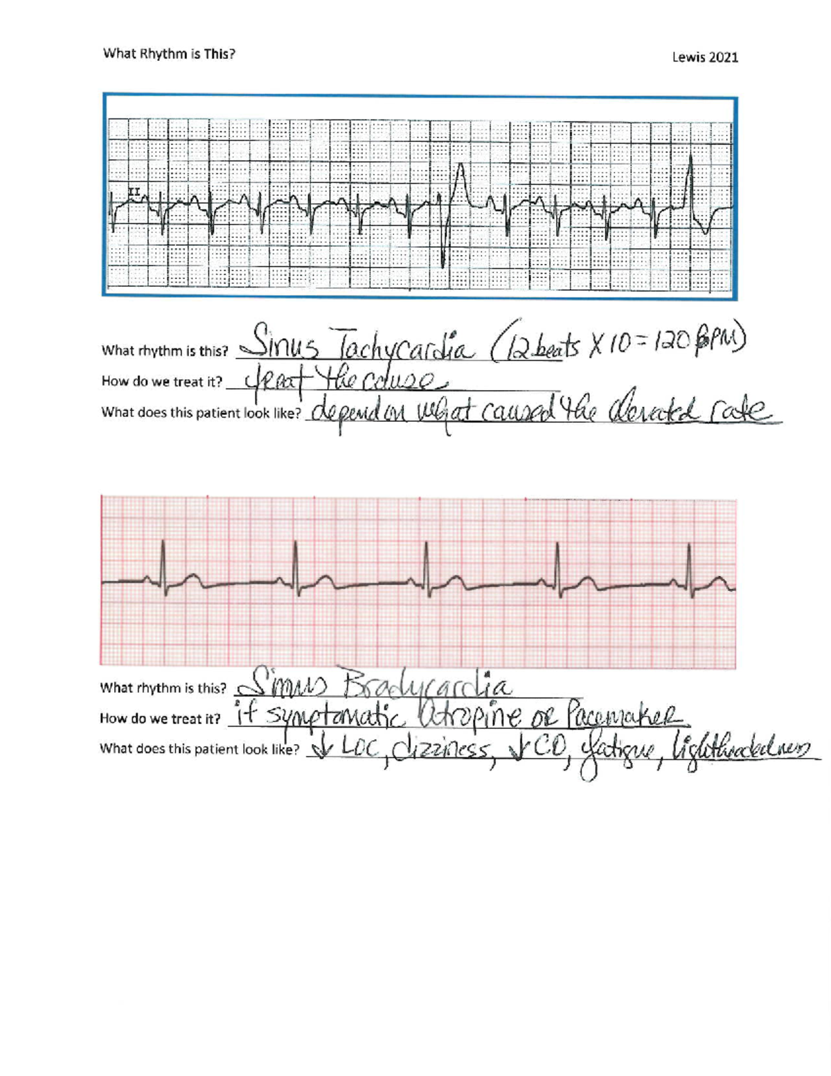 EKG Answer Key - how to read ekg - NR-325 - Chamberlain University ...