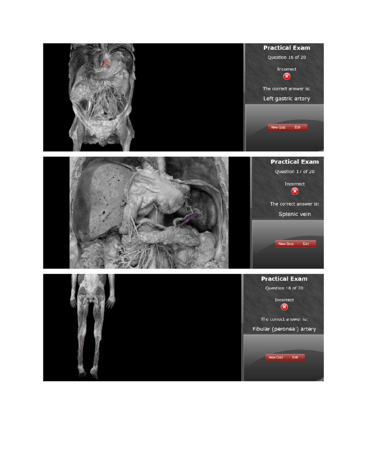 KIN262 Human anatomy Practical 9 - KIN 262 - Studocu