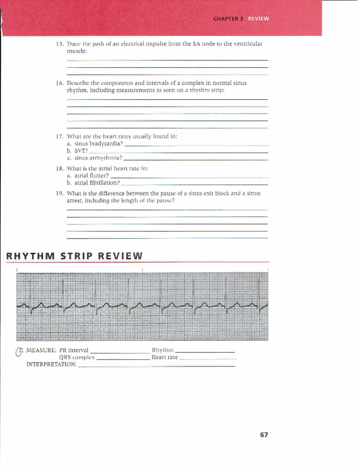 ECG Practice Strips - Review questions for EKG's - 15, Trace the path ...