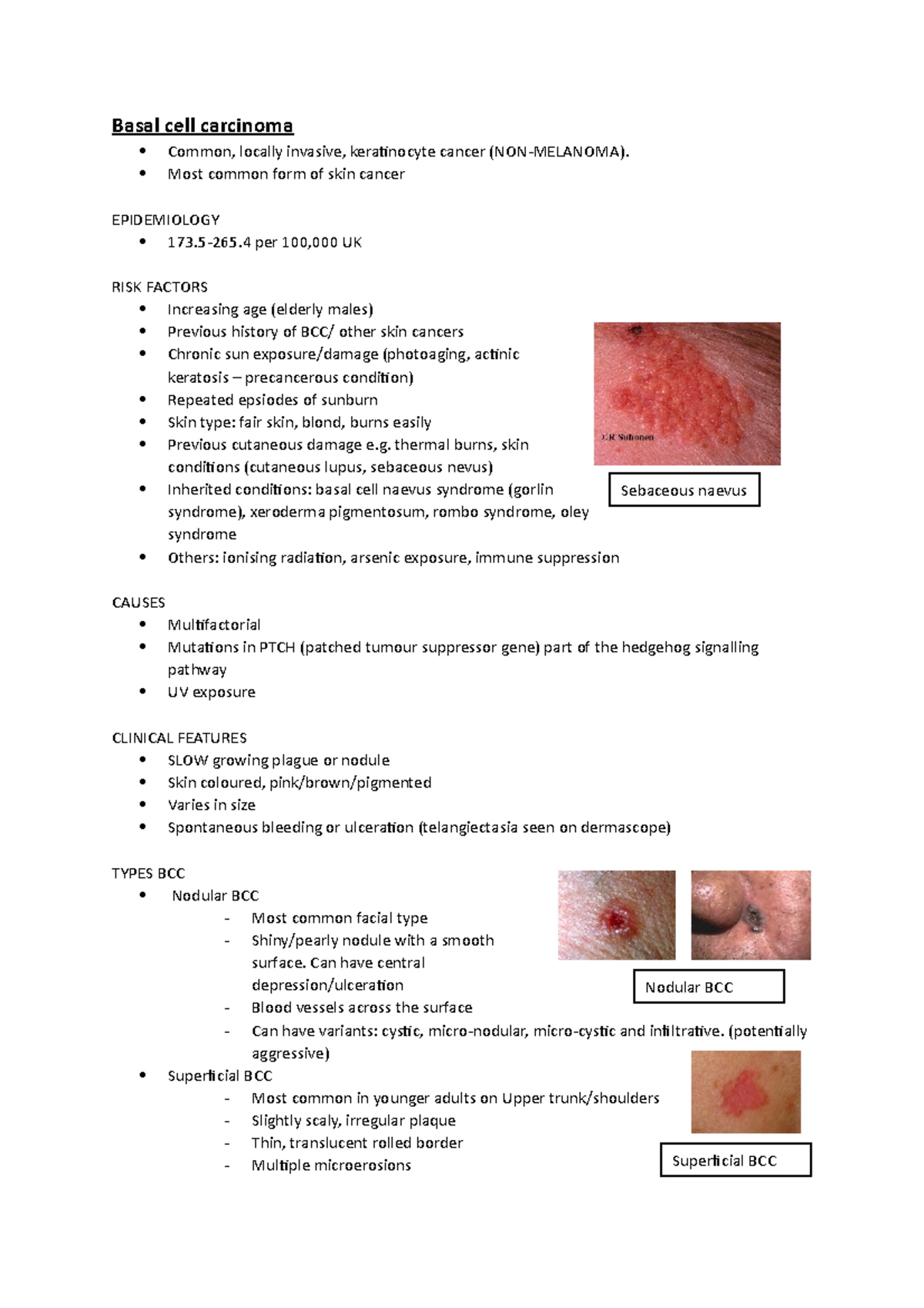 Basal cell carcinoma - Most common form of skin cancer EPIDEMIOLOGY 173 ...